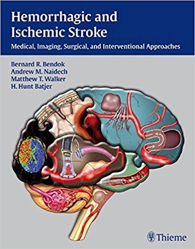 Hemorrhagic and Ischemic Stroke Medical  Imaging  Surgical and Interventional Approaches - نورولوژی